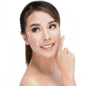Sculptra Fillers in dubai
