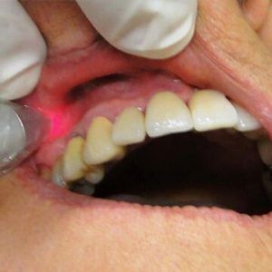 oral surgery