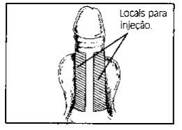 Vista superior do penis