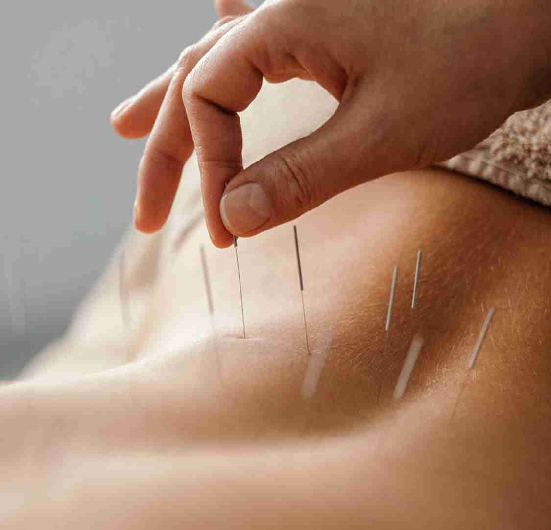 Physiotherapy Services in Simcoe