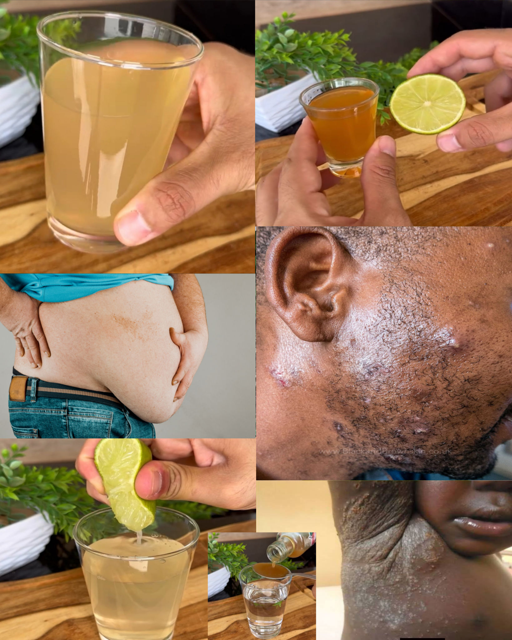 Apple Cider Vinegar, Honey, and Lime: Why You Should Drink This Every Morning