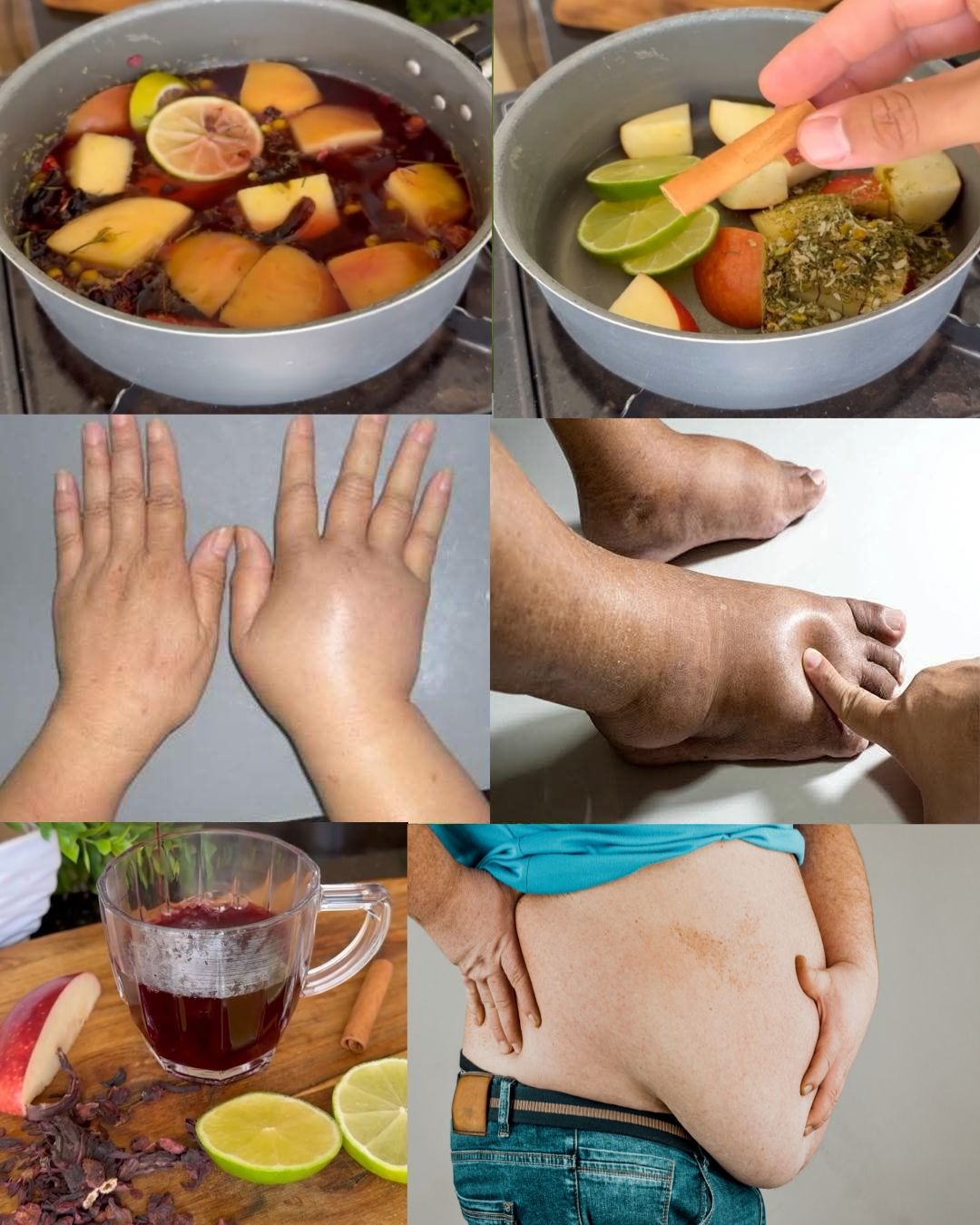 Apple, Lemon, Hibiscus Flowers and Cinnamon: the four powerful ingredients that can manage weight gain...