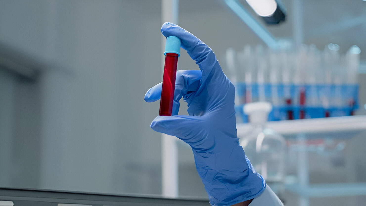 Blood Sample Collection at Home
