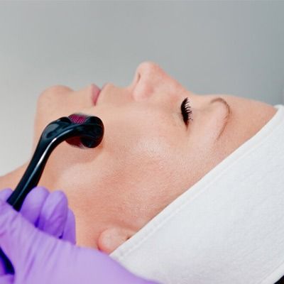 Collagen Induction Therapy Dubai