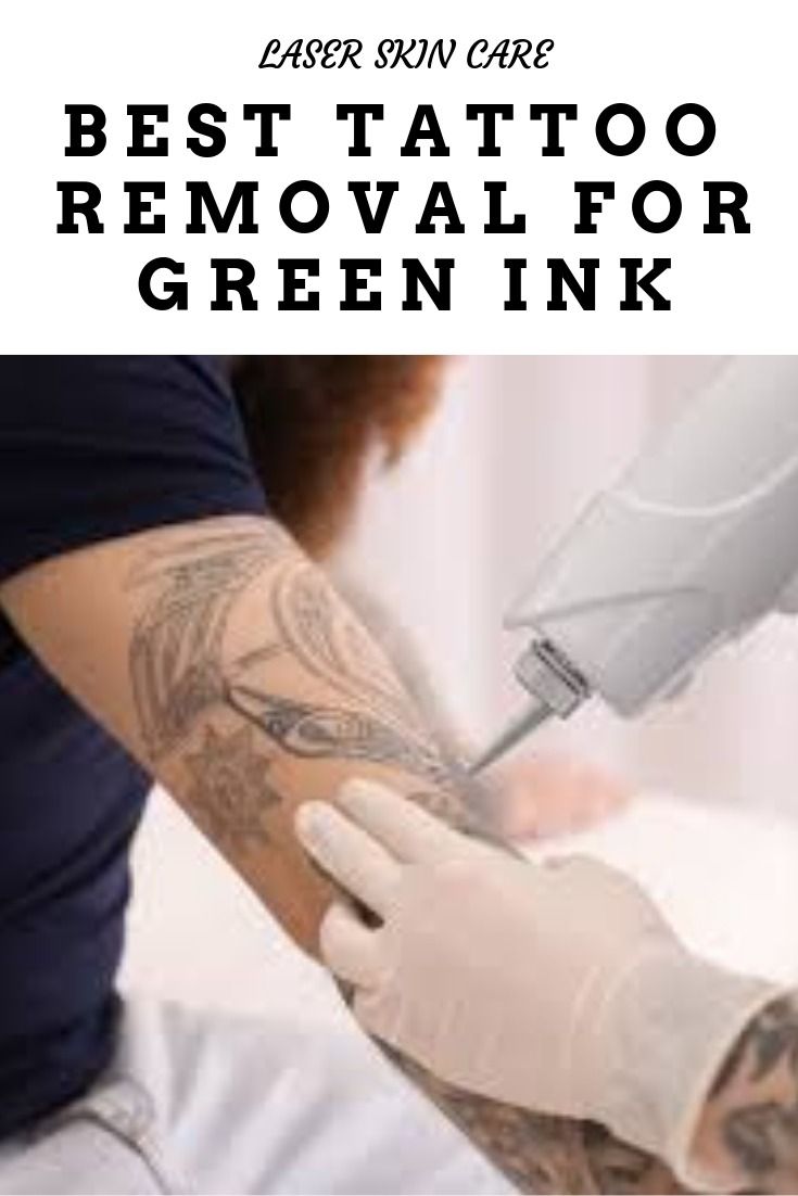 wholesale fotona 4d tattoo removal