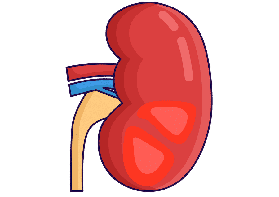 Glomerulonephritis illustration