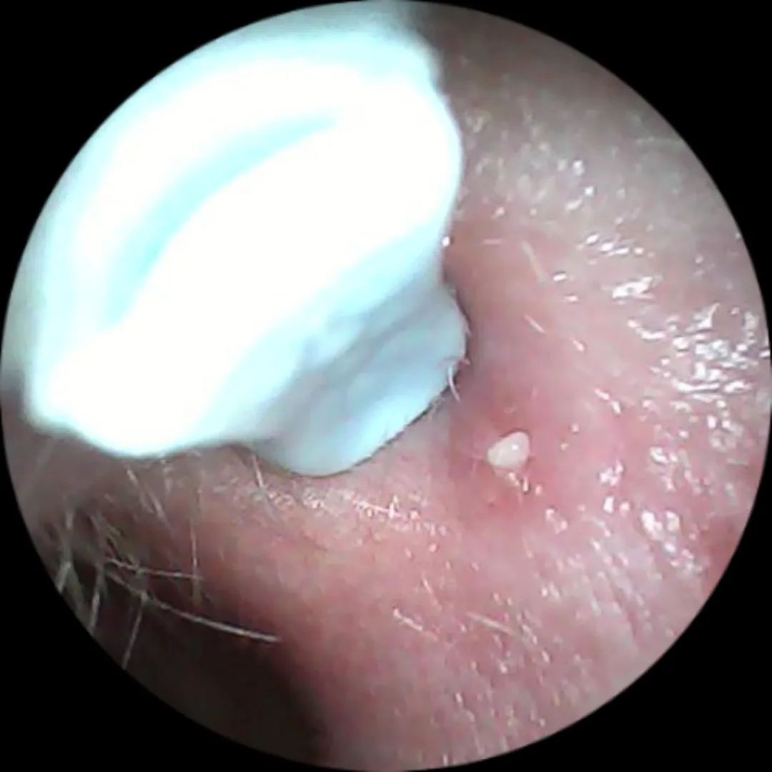 Cliente real usando el limpiador