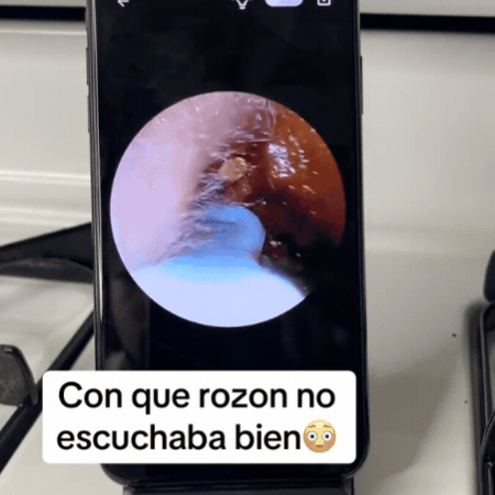 Limpiador de oídos con cámara en uso