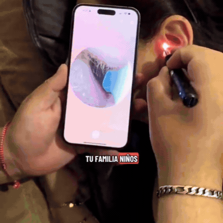 Demostración del limpiador de oídos con cámara conectado al celular