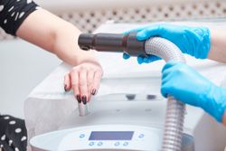 Лечение в Санатории Энергетик - местная криотерапия