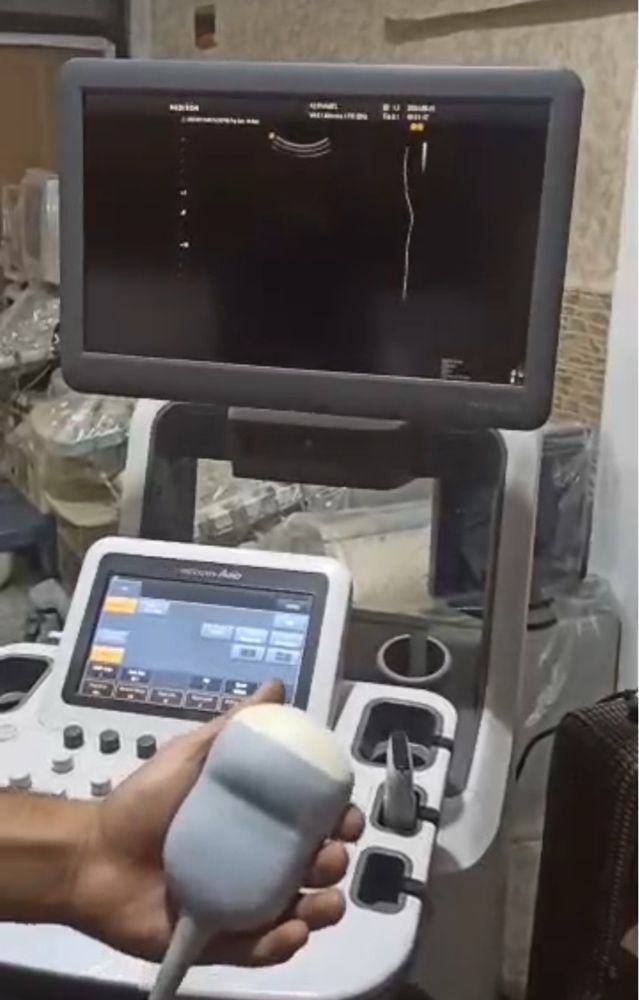Medison (Samsung) Accuvix / SonoAce Series