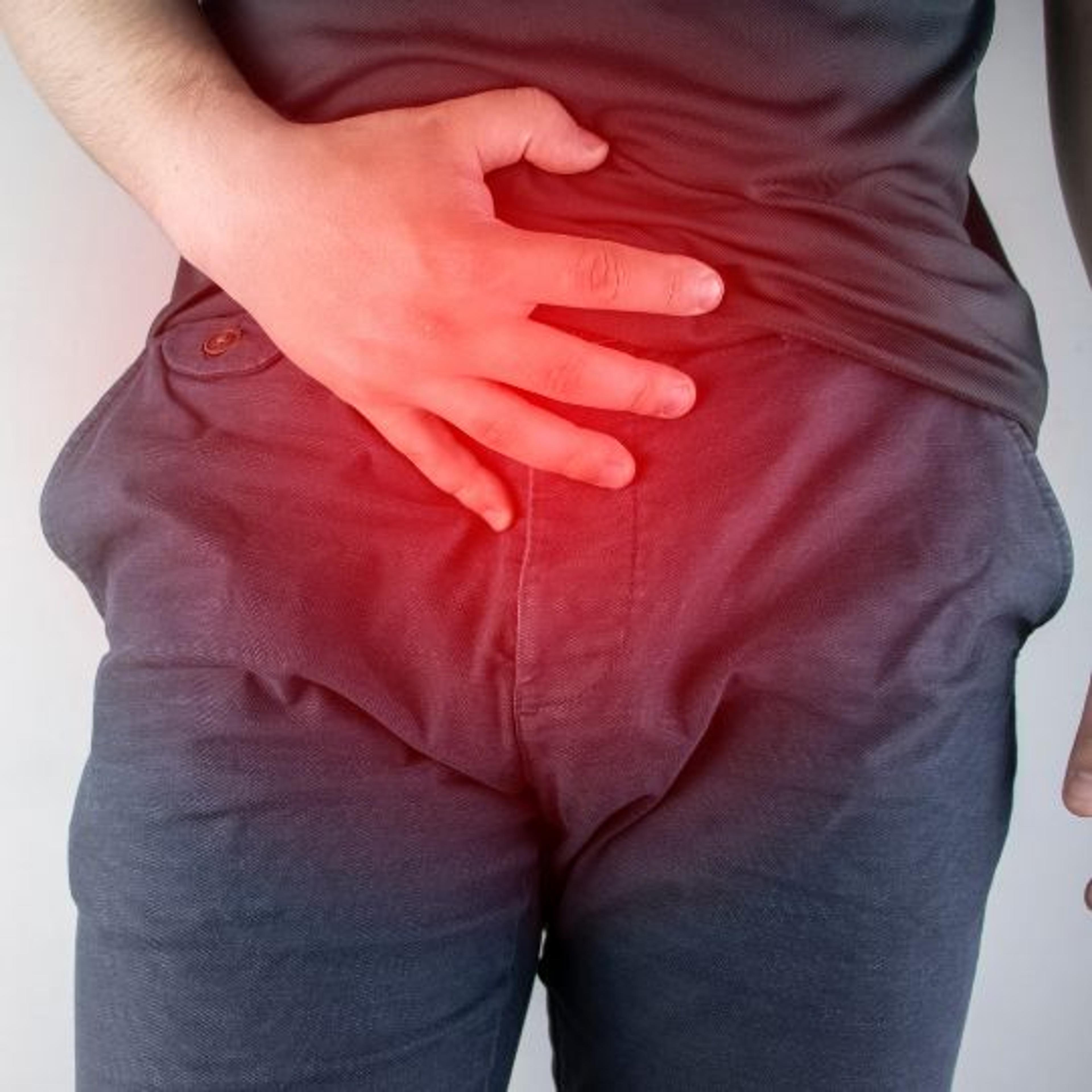 Prostate Enlargement