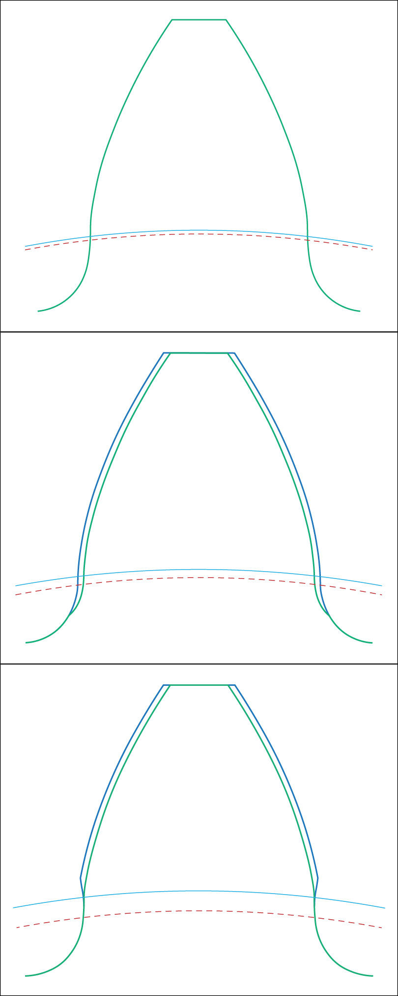 Figure 5—Three different situations that define the root form diameter: Single manufacturing step (top), pre-finishing and grinding (middle), pre-finishing with protuberance tool and grinding (bottom).