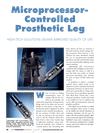 Microprocessor-Controlled Prosthetic Leg