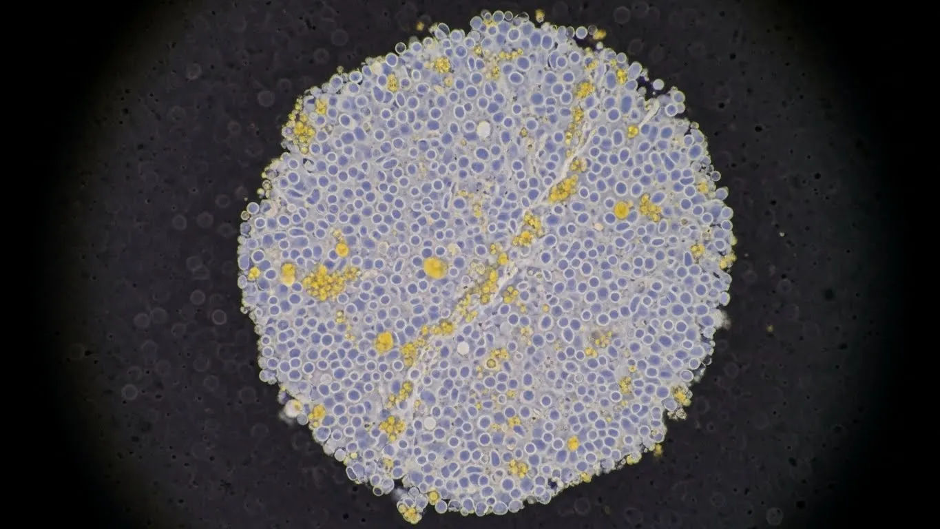 period 2 days late white discharge