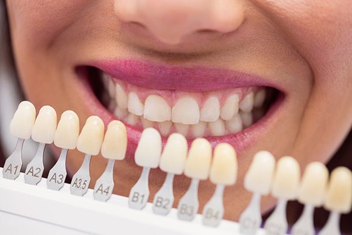 Discover the Differences: Zirconia Tooth Crown vs. Ceramic Tooth Crown | AMD Dental Clinic Discover the Differences: Zirconia Tooth Crown vs. Ceramic Tooth Crown | AMD Dental Clinic