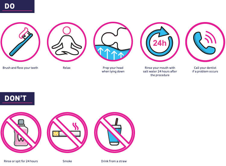 Dos and don'ts after wisdom tooth extraction Dos and don'ts after wisdom tooth extraction