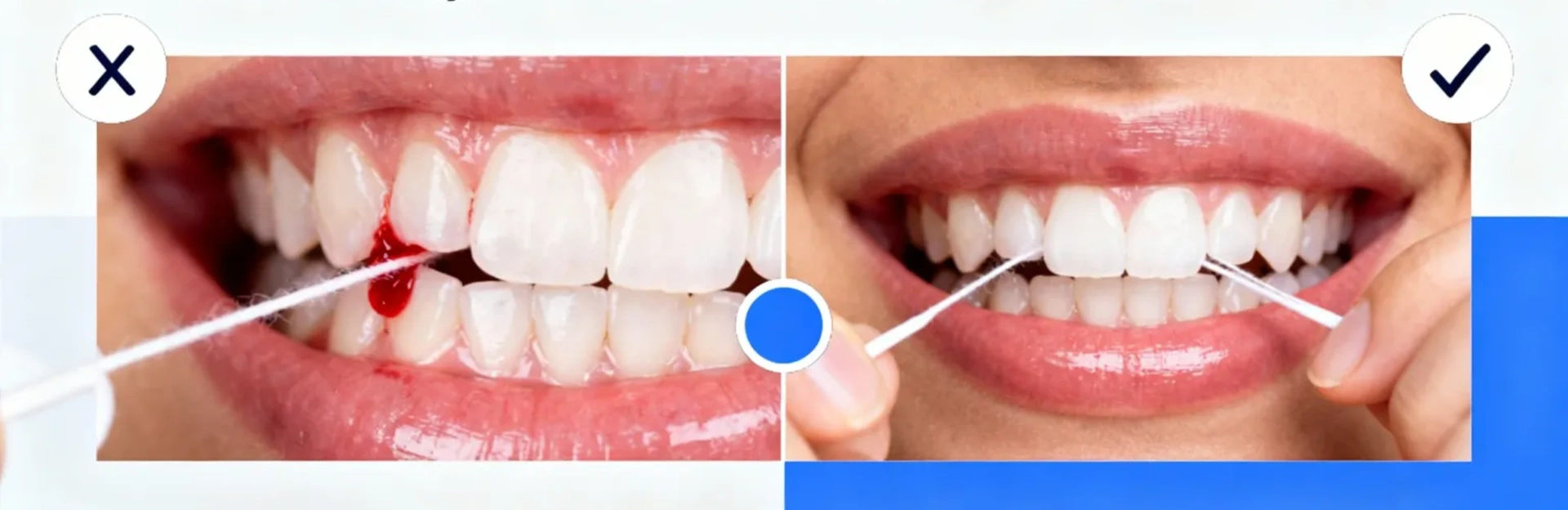 Why Do My Gums Bleed When I Floss? Myths vs. Facts Why Do My Gums Bleed When I Floss? Myths vs. Facts