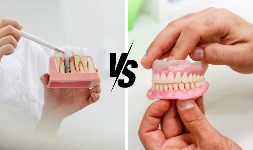 Dental Implants vs Dentures: Which is Right for You? Dental Implants vs Dentures: Which is Right for You?