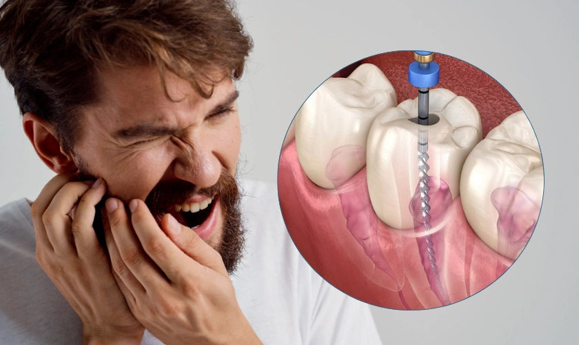Relieving Teeth Pain: Your Ultimate Guide to Root Canal Treatment in Jaipur Relieving Teeth Pain: Your Ultimate Guide to Root Canal Treatment in Jaipur
