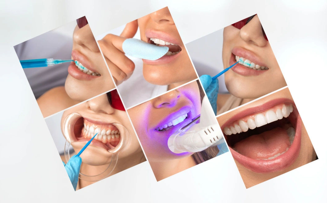 Yellow Teeth Before Wedding? 5 Safe Ways to Brighten Your Smile 