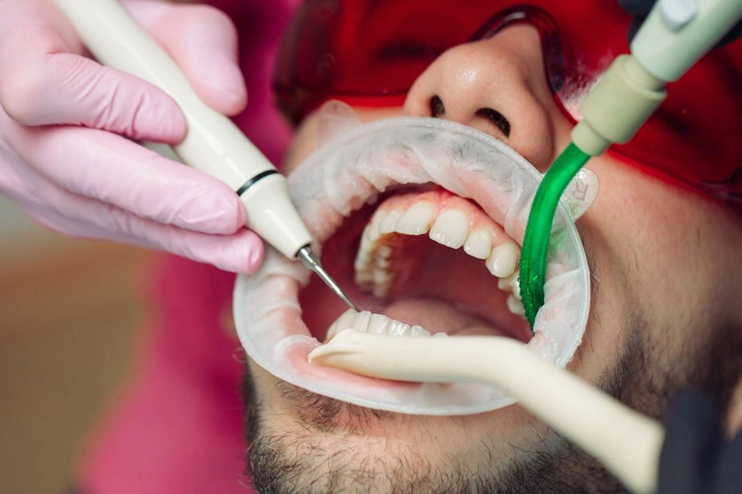 Top 7 Benefits of Regular Teeth Cleaning by a Dentist Top 7 Benefits of Regular Teeth Cleaning by a Dentist