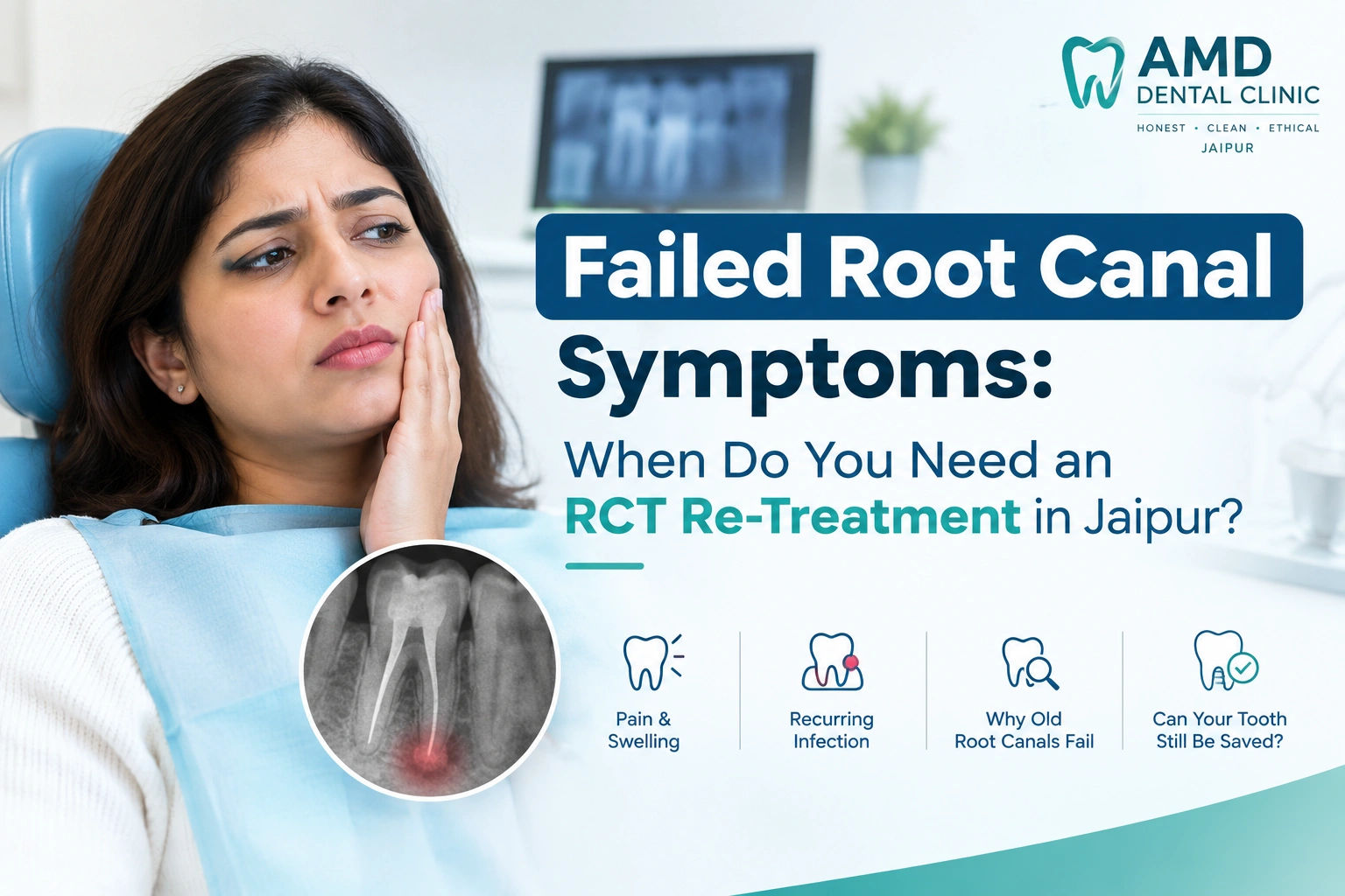 Failed Root Canal Symptoms: When Do You Need an RCT Re-Treatment in Jaipur?