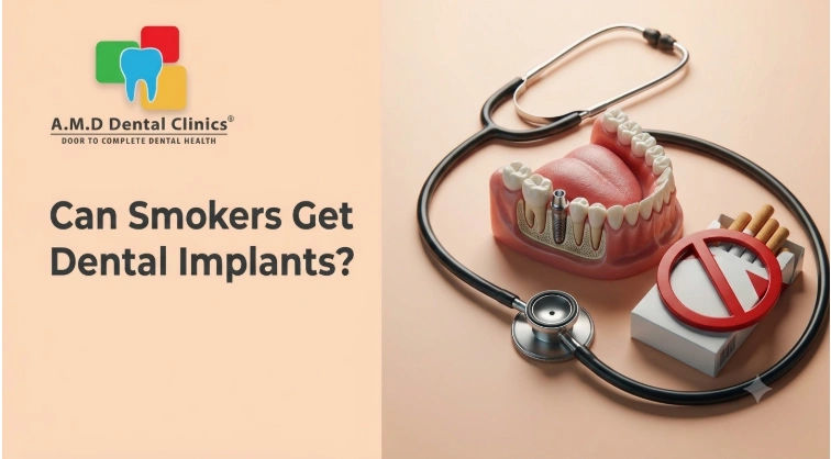 Can Smokers Get Dental Implants? Here's What You Need to Know
Can Smokers Get Dental Implants? Here's What You Need to Know