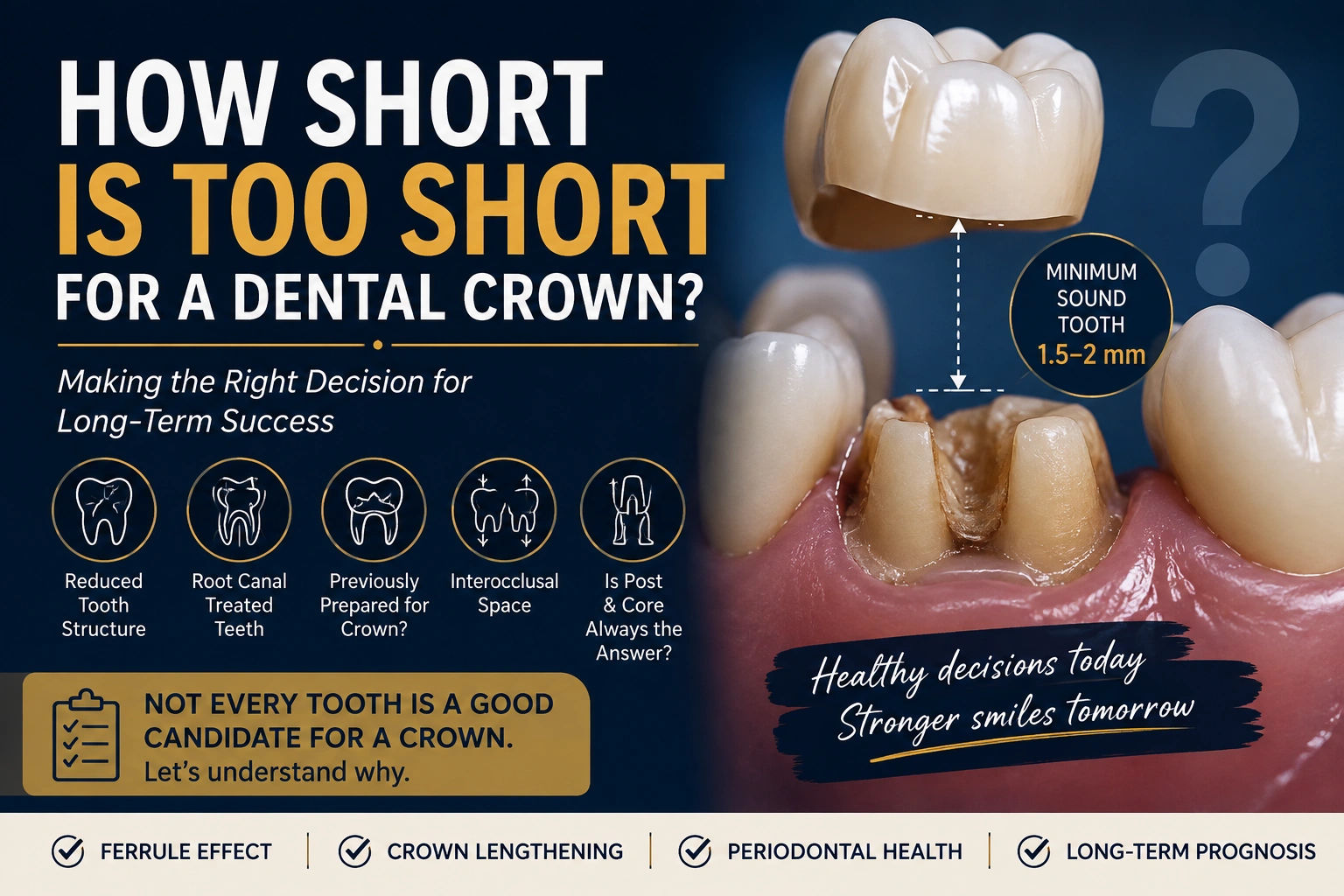 How Short Is Too Short? When a Dental Crown Is Not the Right Answer