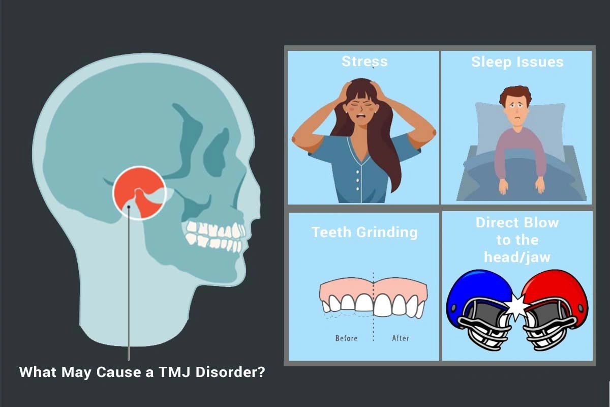 Temporomandibular Joint Disorder (TMJ) – Causes & Treatment in Jaipur