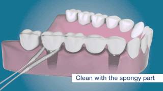 Dental floss to clean dental implant