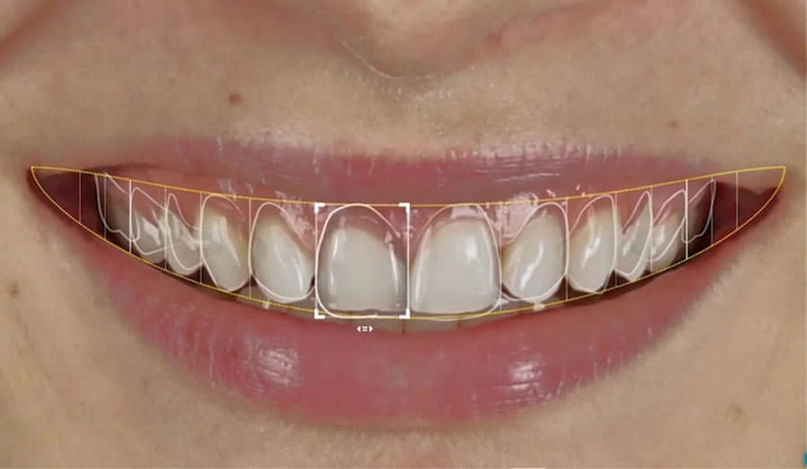 Best Cosmetic Dentist in Jaipur – Why AMD Dental Clinic Is Trusted for Smile Designing & Smile Makeovers