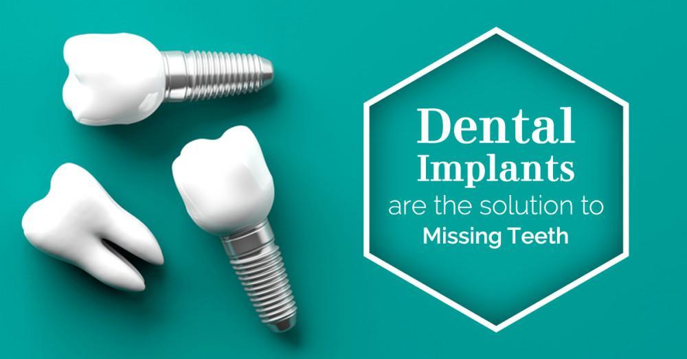 Restoring Smiles: A Successful Dental Implant Journey at AMD Dental Clinic, Jaipur