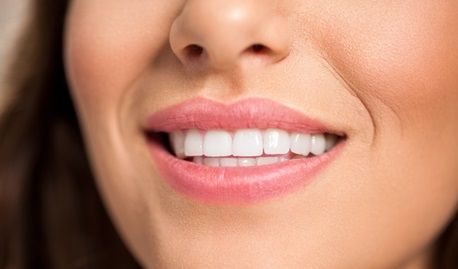 5 Things to Avoid After Whitening Your Teeth