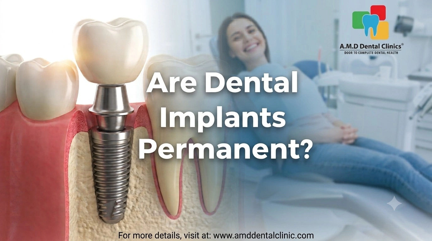 Are Dental Implants Permanent? AMD Dental Clinic