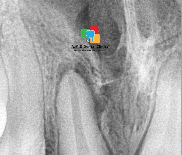 PRE OPERATIVE X-RAY