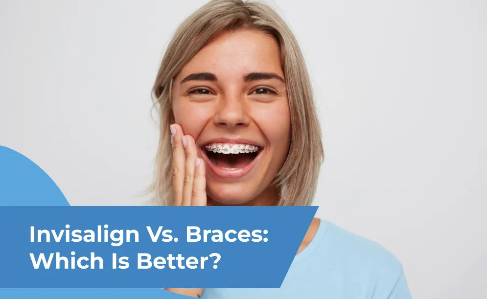 Invisalign vs. braces - which is better?