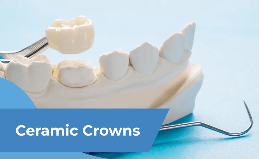 Ceramic Crowns