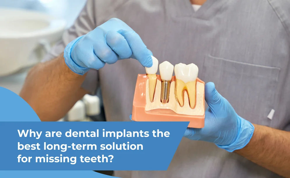 Why are dental implants the best long-term solution for missing teeth?