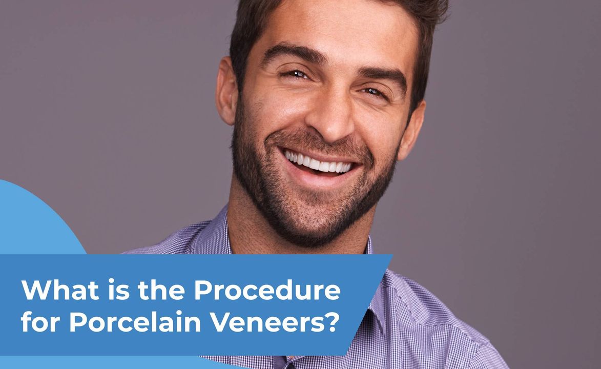 What is the Procedure for Porcelain Veneers?