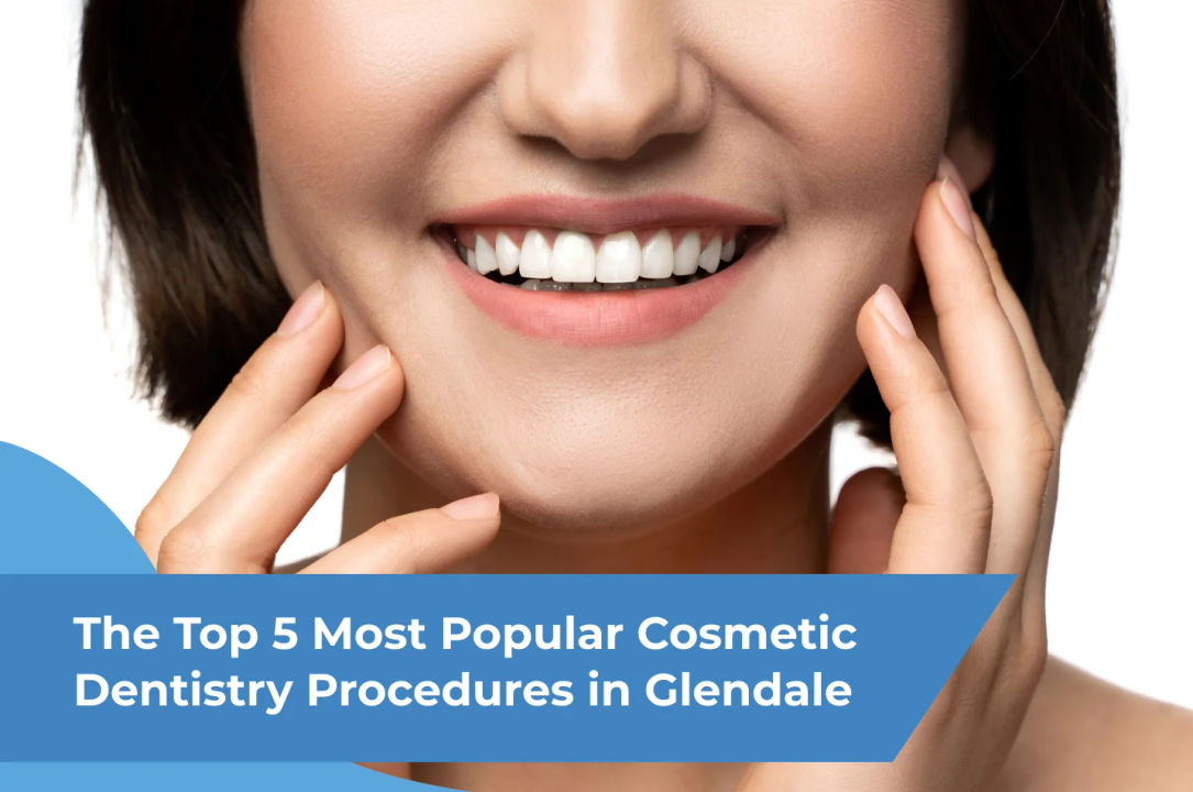 The Top 5 Most Popular Cosmetic Dentistry Procedures in Glendale