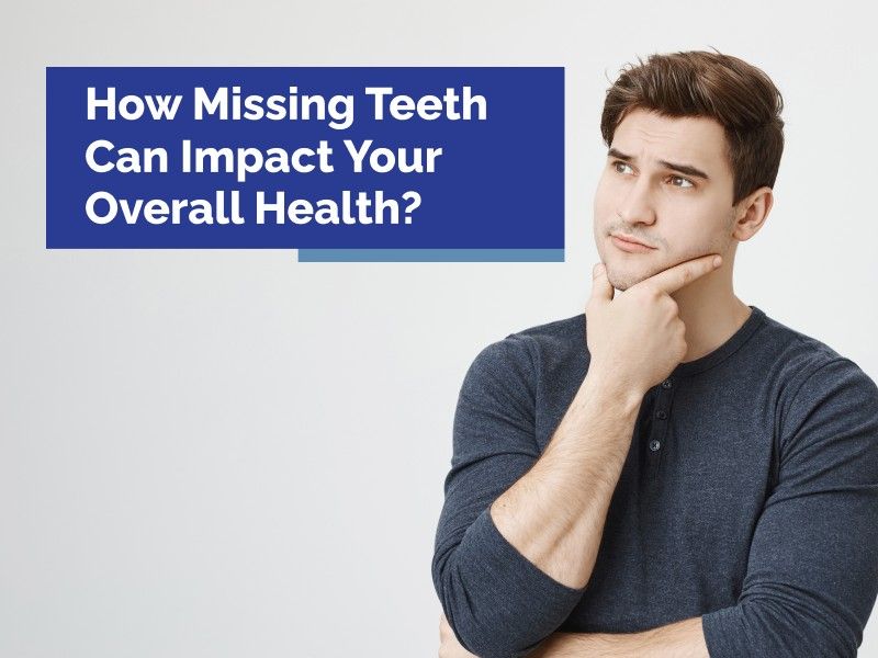 How Missing Teeth Can Impact Your Overall Health?