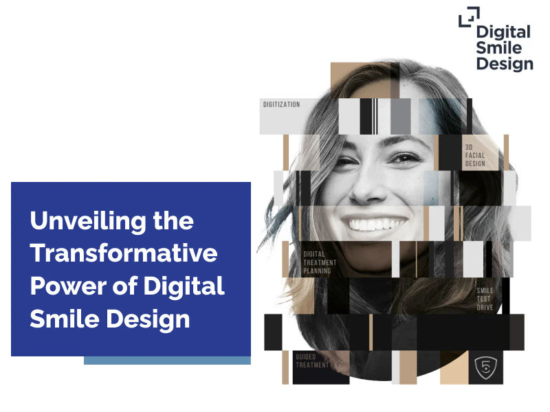 Unveiling the Transformative Power of Digital Smile Design