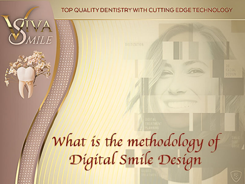 What is the methodology of Digital Smile Design?