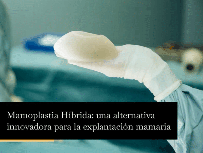 Mamoplastia Híbrida: una alternativa innovadora para la explantación mamaria