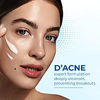 D'Acne Soft Face Wash | Unclogs pores and prevents pimples | Stops recurrence of acne | Contains 1% Glycolic Acid, Niacinamide |Suitable For Oily skin, Acne-prone Skin | Men & women | 100 ml