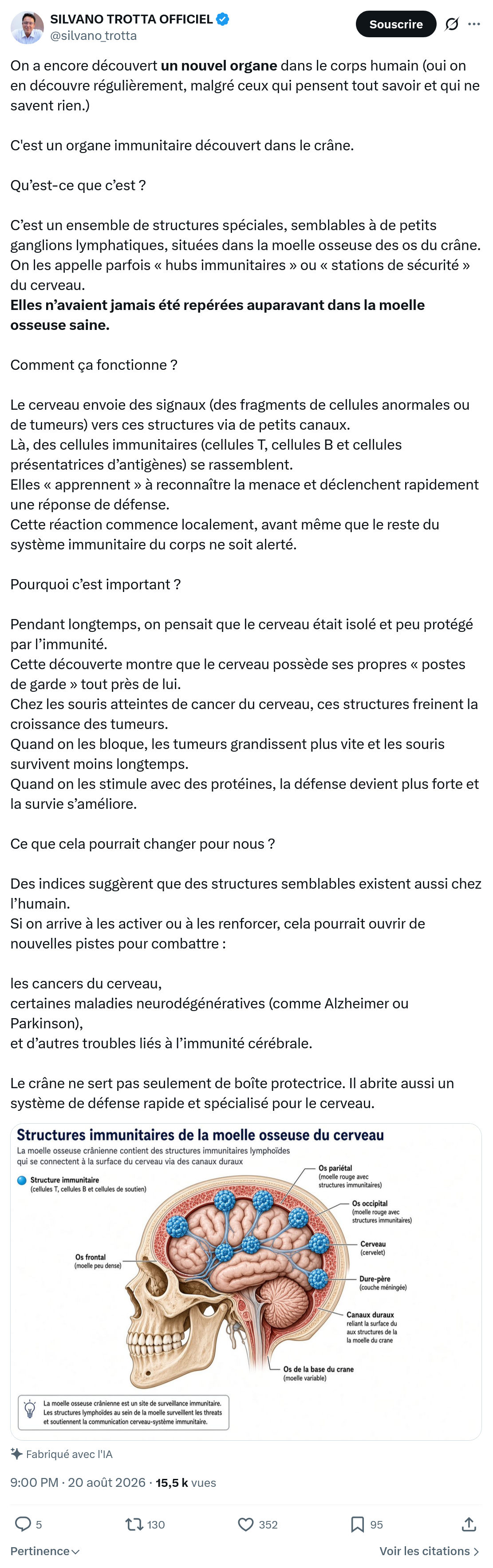 Silvano Trotta: On a encore découvert un nouvel organe...