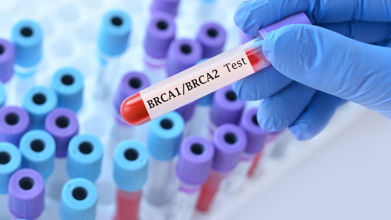 Testele Genetice BRCA1 și BRCA2