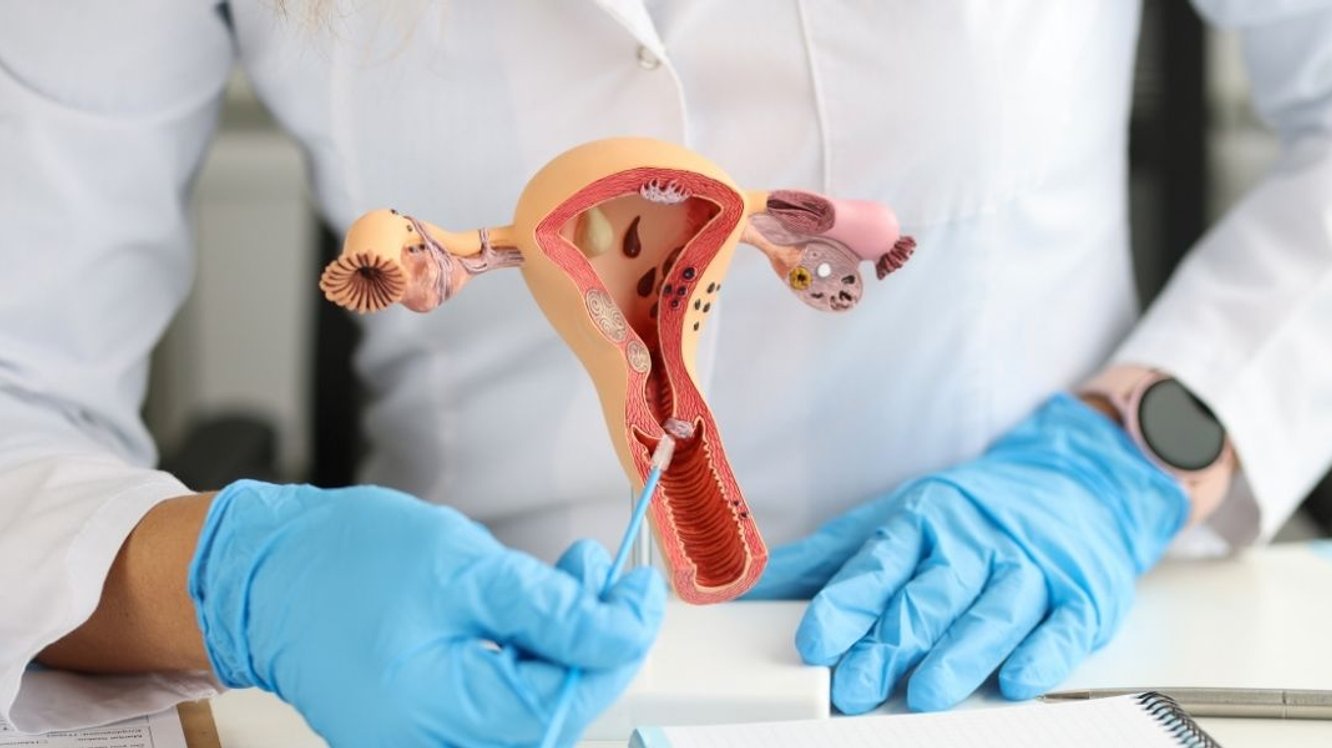 Cancerul de endometru – Cauze. Simptome. Tratament