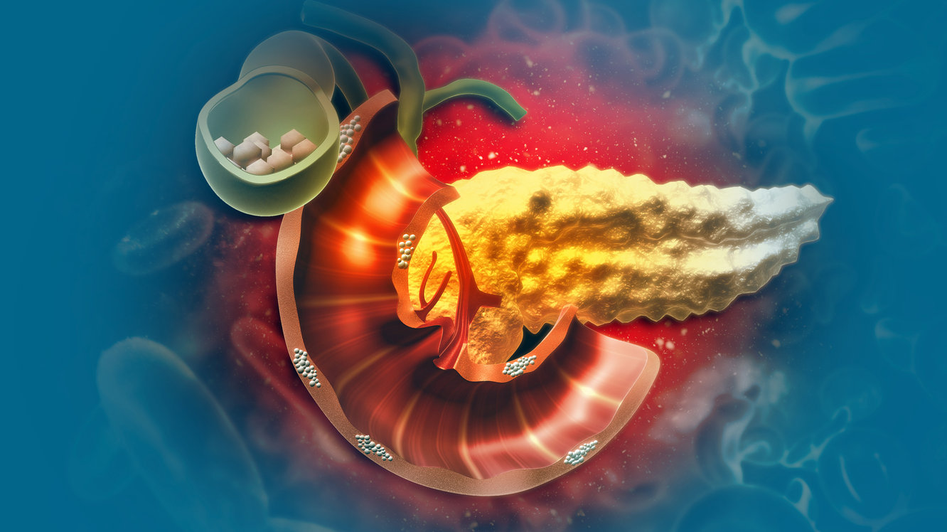 Ce este ERCP?